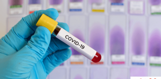 Për ‘partizanët’ e testimit masiv (depistimit) të COVID-19, pak artimetikë