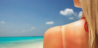 Acarimi i nishanëve dhe problemet që shkakton dielli, ndiqni këshillat që jep dermatologia