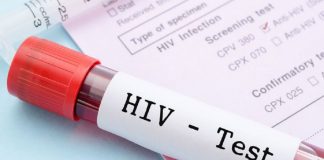Dita Botërore kundër HIV/AIDS, në Shqipëri mbi 1500 raste, shumica meshkuj