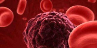 Kanceri i gjirit, mjeket: Në cilat raste duhet të kontrolloheni edhe nëse jeni në moshë të re