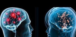 Studimi për personat që kanë kaluar Covid-19/ Ja efektet e forta tek shëndeti i trurit