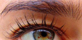 Keni njolla në sy? Ja çfarë duhet të dini