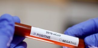 Kostot ekonomike kërkojnë që e gjithë bota të vaksinohet sa më shpejt