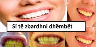 S’keni pse harxhoni para tek dentisti, këto 3 mënyra natyrale zbardhin dhëmbët menjëherë