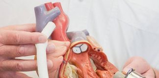 Prodhohet zemra artificiale, ja sa kushton ajo