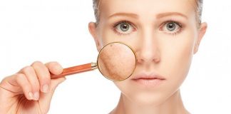 3 arsye pse ju shfaqen njolla të errëta në lëkurë!