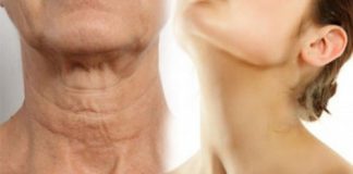 Ky gabim i përditshëm po ju bën qafën me rrudha të cilat nuk hiqen