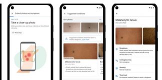 “Google” vjen me një aplikacion të ri që njeh deri në 288 sëmundje të lëkurës, flokëve dhe thonjve