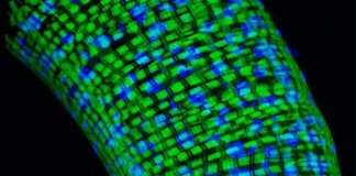 Lista e gjeneve të plakjes duhet të rishkruhet