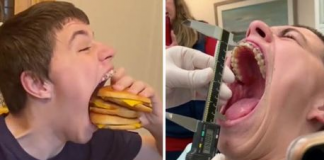 Adoleshenti thyen rekordin botëror Guinness për gojën më të gjerë, ja sa centimetër kap me një kafshim