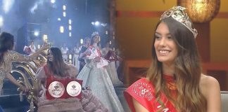 Miss Shqipëria 2020 rrëfen si e bullizonin për gjatësinë