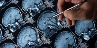 Mënyra se si ngisni makinën tregon nëse jeni të prirur për të pasur Alzhemier