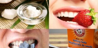 Njihuni me 4 mënyra natyrale si të zbardhni dhëmbët, kujdesi që ju duhet