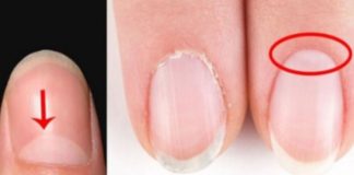 Nëse i keni këto “gjysmëhëna” të bardha në thonjtë tuaj, atëherë duhet ta lexoni patjetër këtë