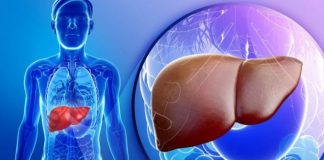 Si ndikon mbipesha te diabeti dhe dhjamosja e mëlçisë