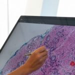 Mbretëria e Bashkuar në alarm! Parashikohen mbi 6 milionë raste të reja me kancer deri në vitin 2040