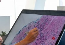 Mbretëria e Bashkuar në alarm! Parashikohen mbi 6 milionë raste të reja me kancer deri në vitin 2040