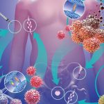 Nanoteknologjia dhe AI zbulojnë kancerin e prostatës në fazë të hershme?