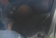 Pamje të rënda nga atentati në Rinas/ Viktima dhe i plagosuri brenda “Benz”-it pak çaste pas breshërive