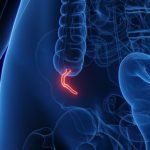 Një lloj i rrallë kanceri po shfaqet tek të rinjtë dhe ekspertët janë të habitur