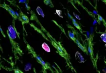 Zemra mund të rigjenerohet pjesërisht pas një infarkti