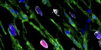 Zemra mund të rigjenerohet pjesërisht pas një infarkti