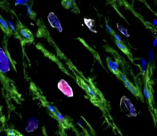 Zemra mund të rigjenerohet pjesërisht pas një infarkti