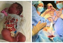 Bekimi i Vitit të Ri, dy vajza janë bebet e para të 2026-ës, Rama ndan lajmin: Mirë se erdhët!