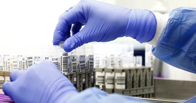 SHBA ja publikon të dhëna për laboratorë biologjikë në mbi 30 vende  përfshirë Ukrainën