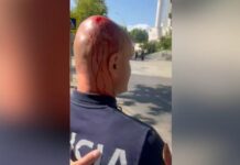 Polici i mbuluar në gjak nga sulmet e protestuesve, Balla: S’është më protestë paqësore, por terrorizëm