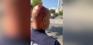 Polici i mbuluar në gjak nga sulmet e protestuesve, Balla: S’është më protestë paqësore, por terrorizëm