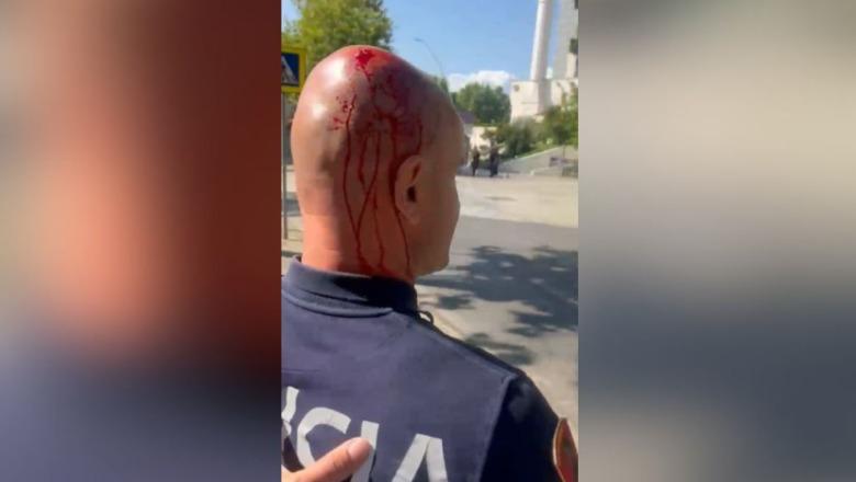 Polici i mbuluar në gjak nga sulmet e protestuesve  Balla  S është më protestë paqësore  por terrorizëm