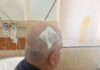 Përplasjet para Parlamentit, pesë efektivë të plagosur, tre prej tyre me dëmtime në kokë
