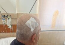 Përplasjet para Parlamentit, pesë efektivë të plagosur, tre prej tyre me dëmtime në kokë