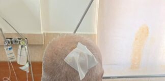 Përplasjet para Parlamentit, pesë efektivë të plagosur, tre prej tyre me dëmtime në kokë