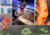 Denoncimi i turistëve italianë për dhunë nga disa të rinj në Tiranë, reagon Policia: U përfshinë në konflikt me një grup të miturish, rasti po hetohet