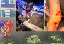 Denoncimi i turistëve italianë për dhunë nga disa të rinj në Tiranë, reagon Policia: U përfshinë në konflikt me një grup të miturish, rasti po hetohet