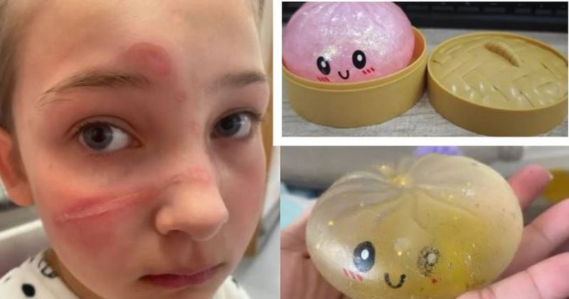 Alarm për lodrat  squishy   SHBA i tërheq nga tregu  Janë të rrezikshme për jetën e fëmijëve