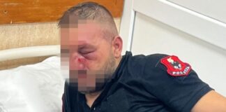 Policia e Shtetit përsërit thirrjet e bëra përgjatë gjithë ditës së sotme për pjesëmarrësit në tubim: Distancohuni menjëherë nga dhuna!