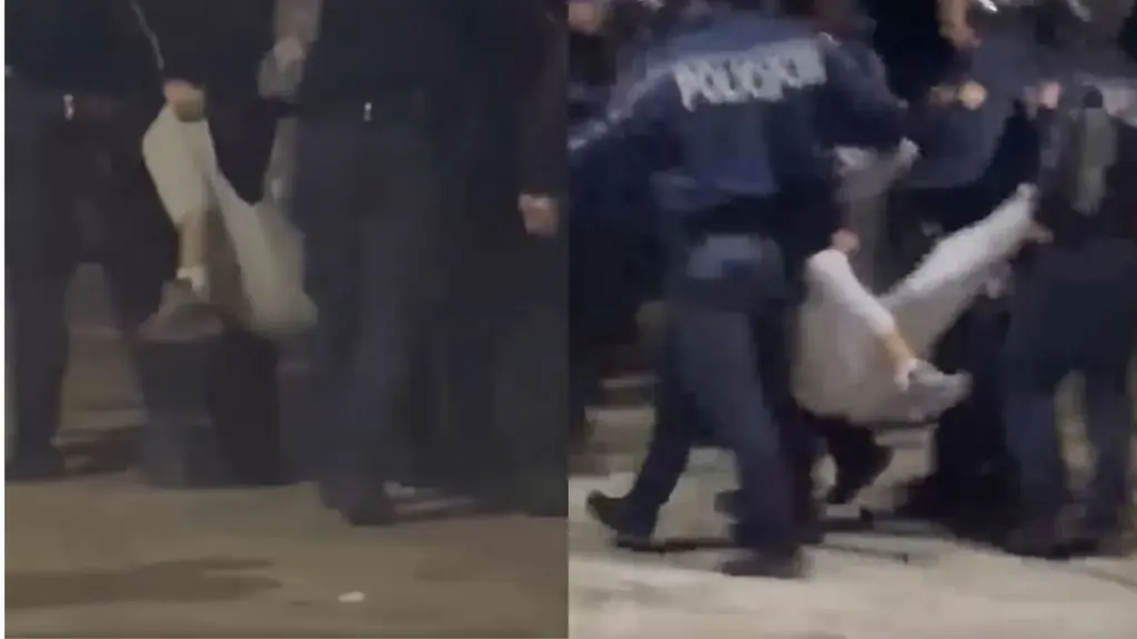 Efektivët e dhunuan dhe i thyen këmbën  19 vjeçari nuk ishte protestues  por kalimtar